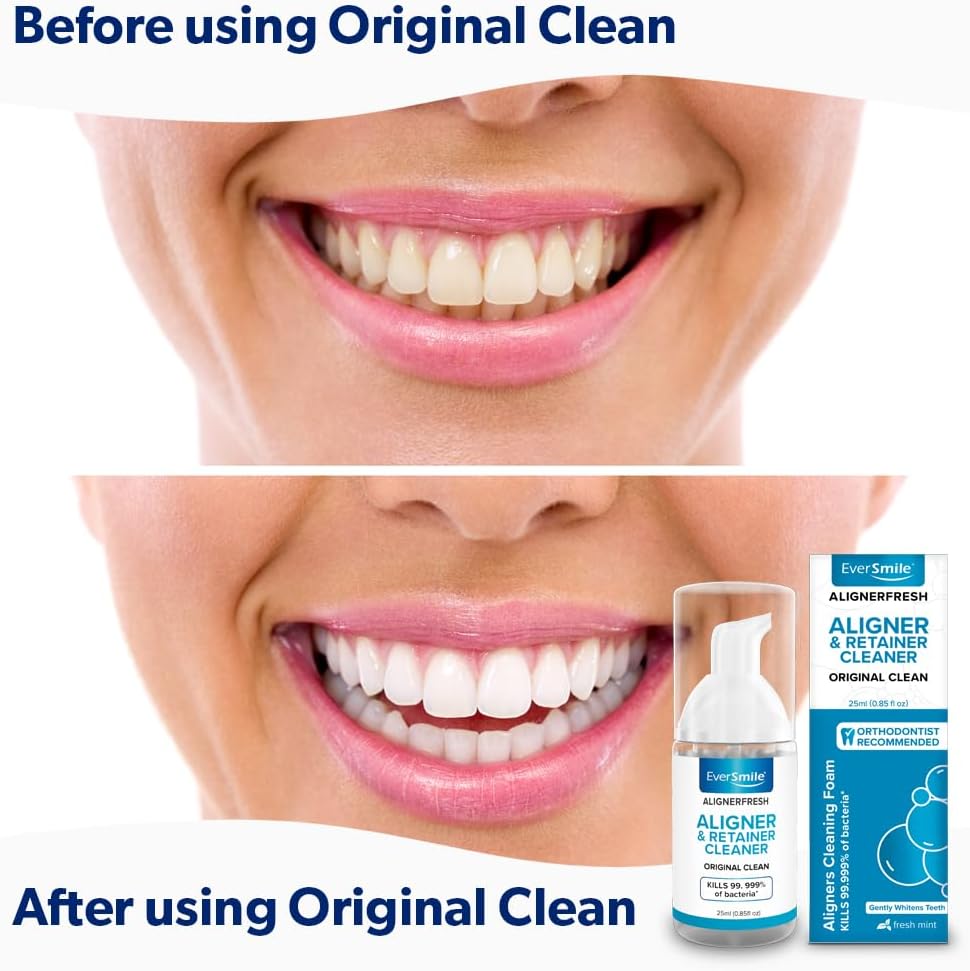 Ever Smile White Foam Aligner Cleaner 25ml